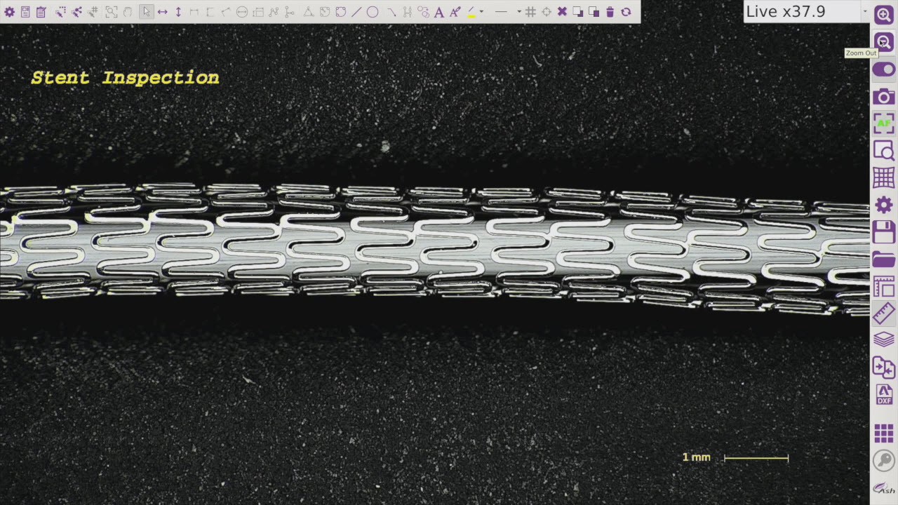 Stent Inspection Using the OMNI Core